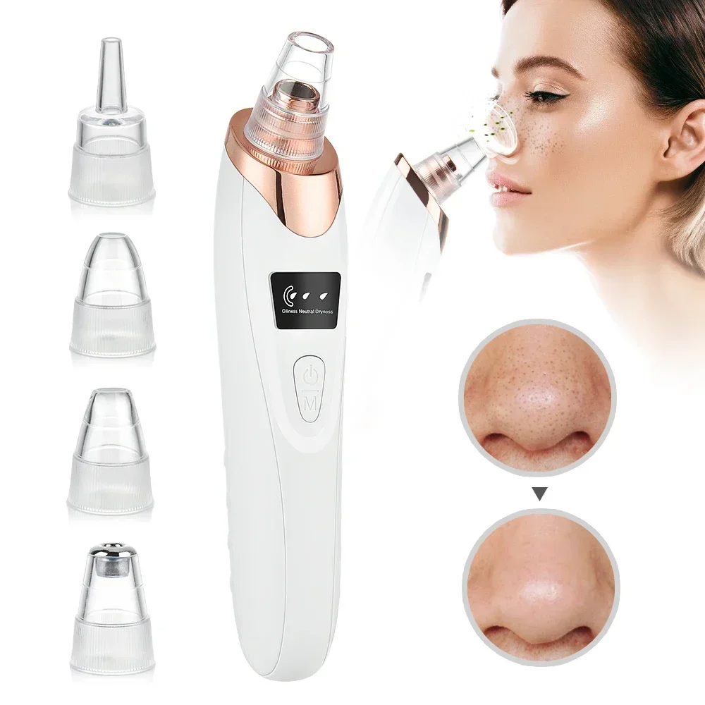 PoreRemover Gerät Nahaufnahme