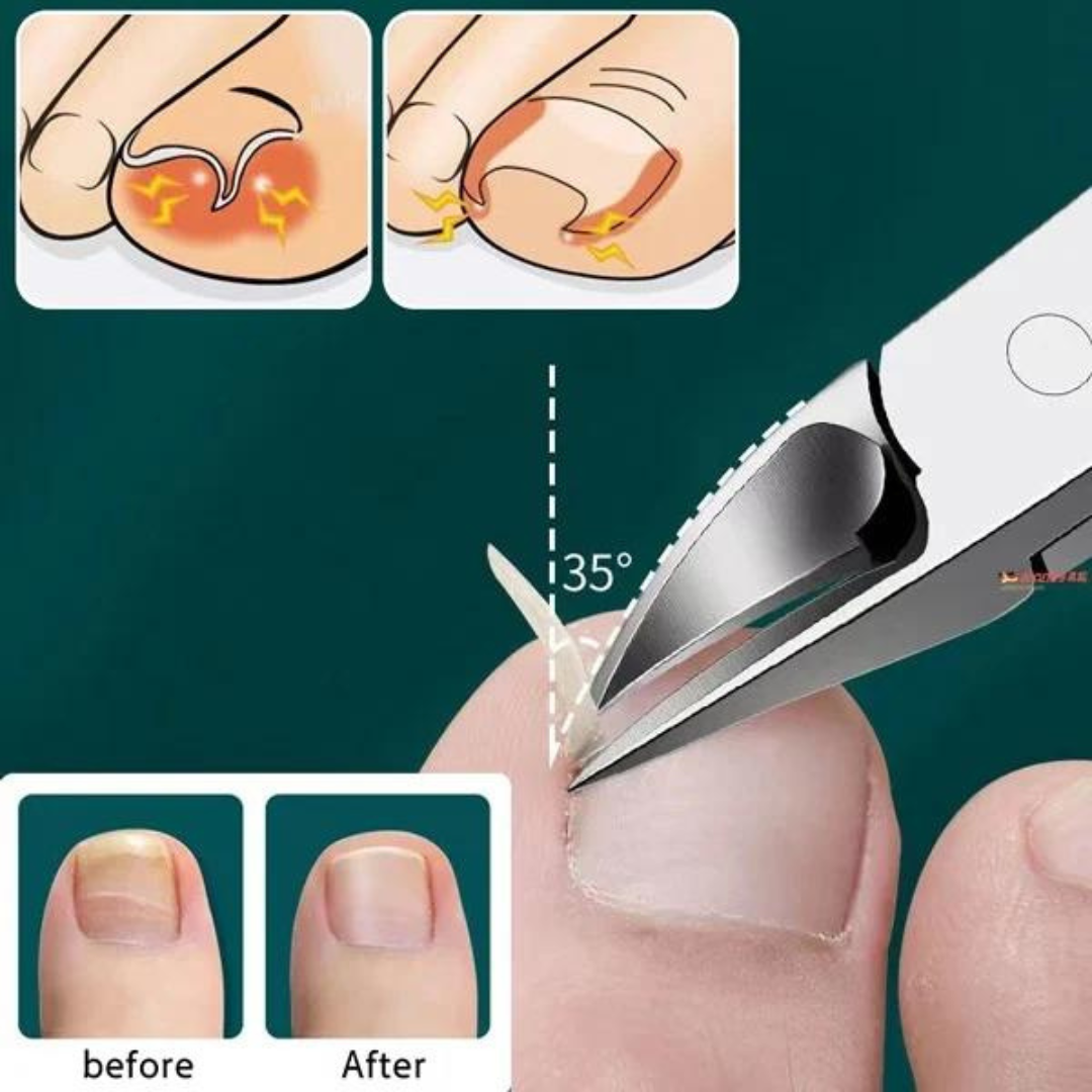 Nipper Professionelle Nagel- Und Nagelhautzange